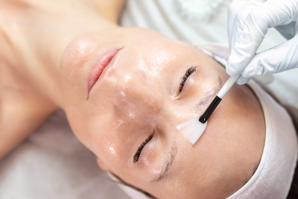 Medical Chemical Peels